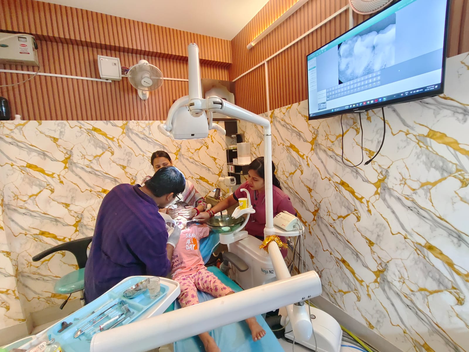 Veneers Restoration
